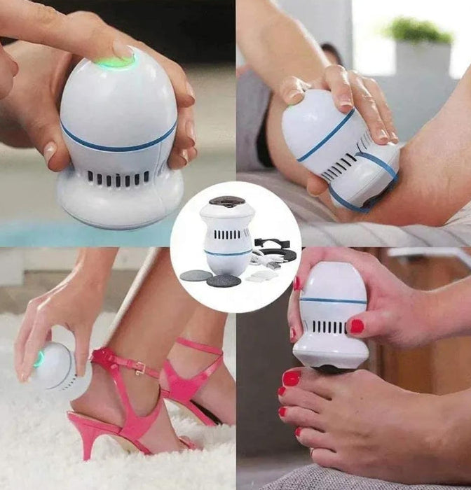 Gentle Electric Body Hair Remover